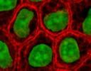  :    160px-Epithelial-cel