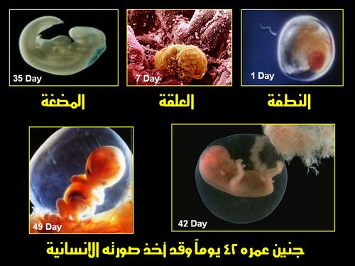embryo_human_001.JPG
