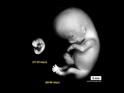   embryo_human_004.JPG