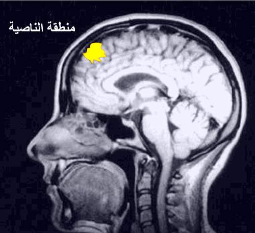 fMRI_frontal_brain02.JPG