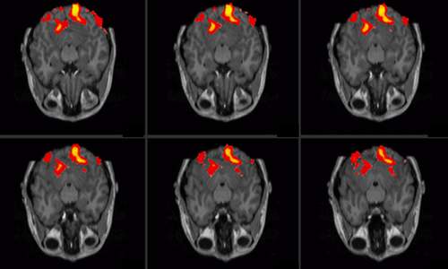 fMRI_frontal_brain04.JPG